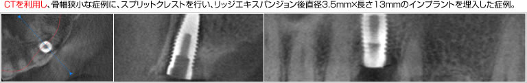 あんざい歯科クリニック最新医療機器CT