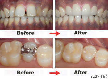 審美治療・セラミック治療実例